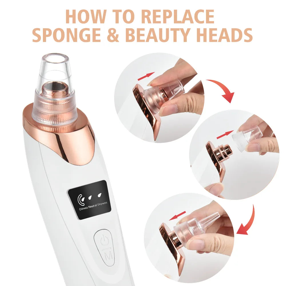 Electric Blackhead Facial Remover