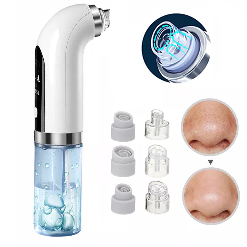 Rechargeable Blackhead Remover