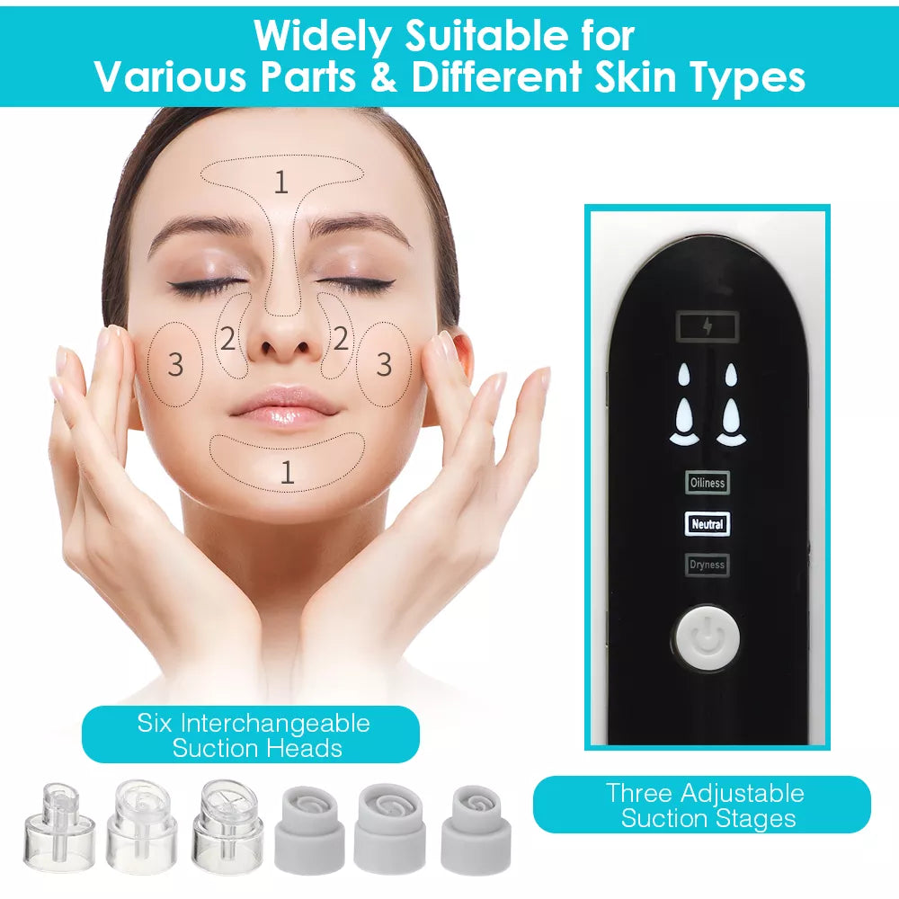 Rechargeable Blackhead Remover