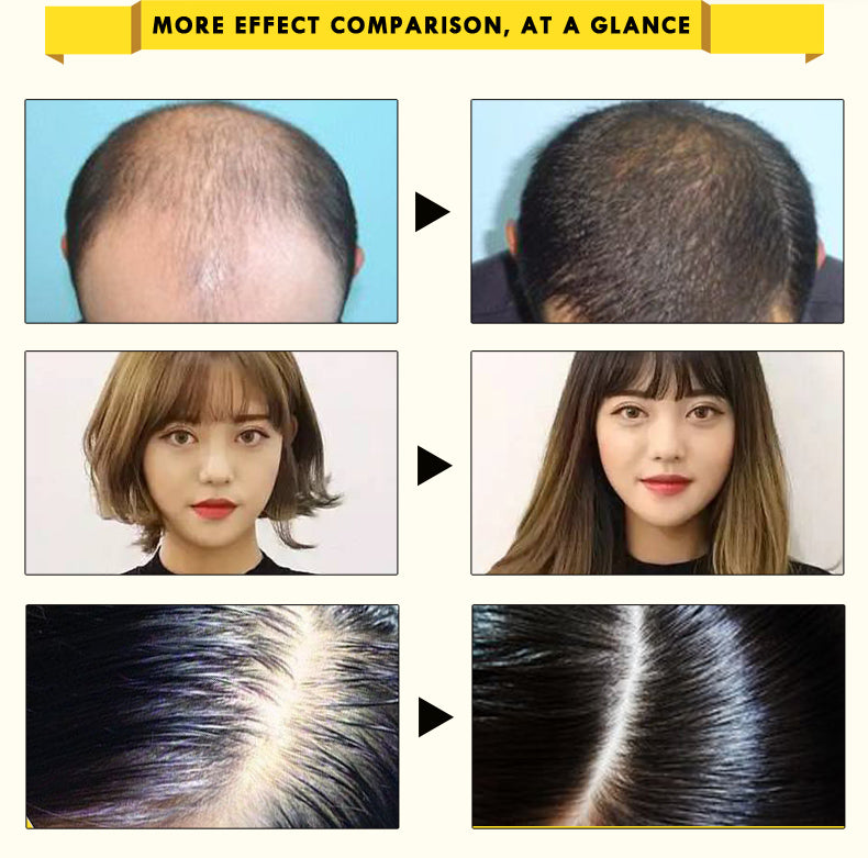 Ginseng Hair Growth